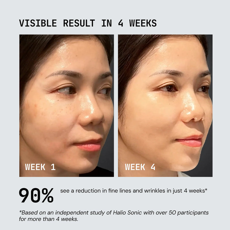 Nuvio UltraLight LED-Maske