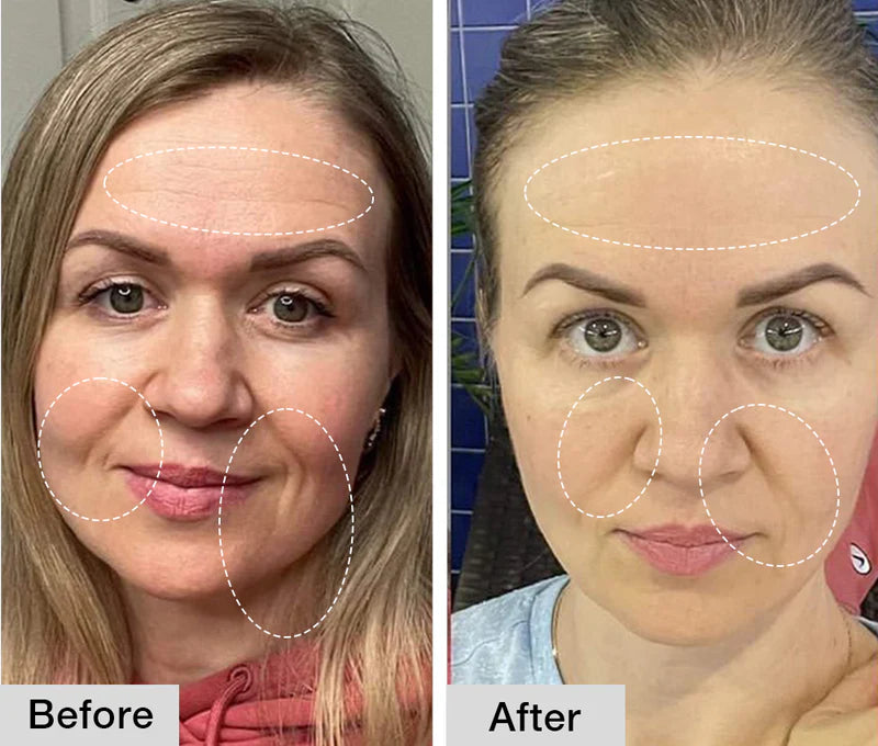 Nuvio Pro Rejuvenator