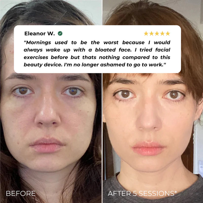 Nuvio EMS Patch Full Face Set