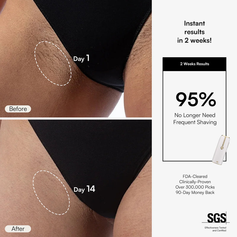 Nuvio IPL-Haarentfernungsgerät