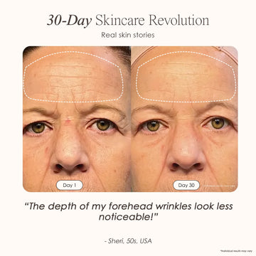 Nuvio 9-Spektrum Anti-Aging-Therapiemaske