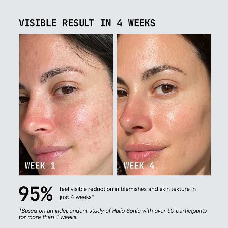 Nuvio UltraLight LED-Maske